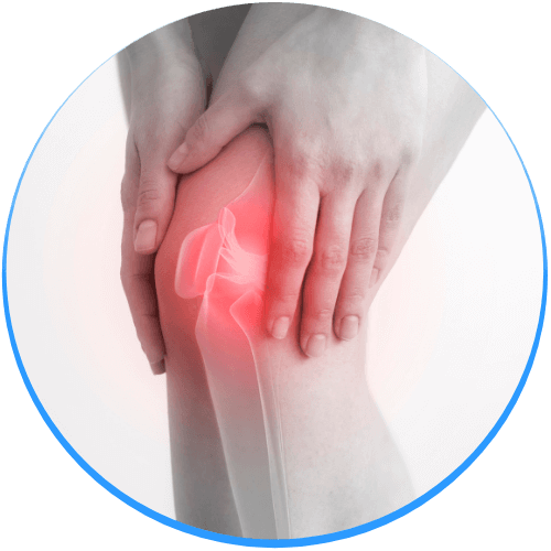 膝を痛めているイメージ写真