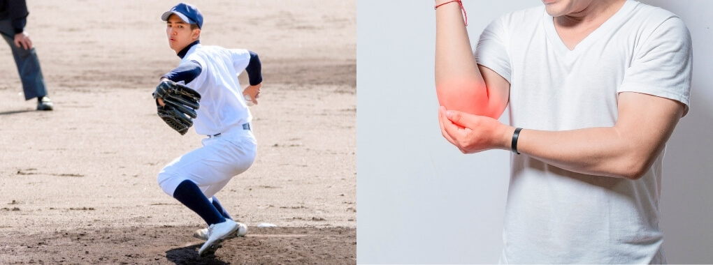 肘を痛めているイメージ写真