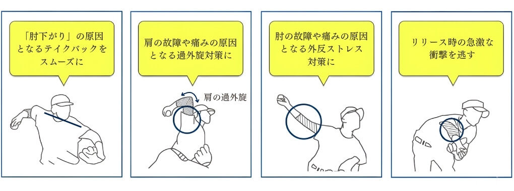 ブレイスレボのポイントをイラストで紹介
